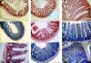Effect of IMUREGEN nucleotide in stomach lining villi growth imuregen study